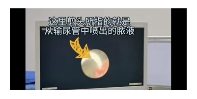 高烧39℃,罪魁祸首竟是它?医生:再晚点后果不堪设想!2.png